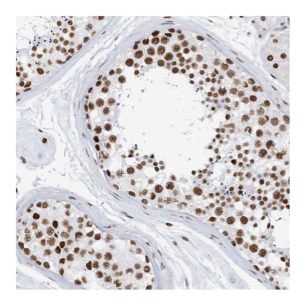 Atlas Antibodies Anti-KHSRP Antibody