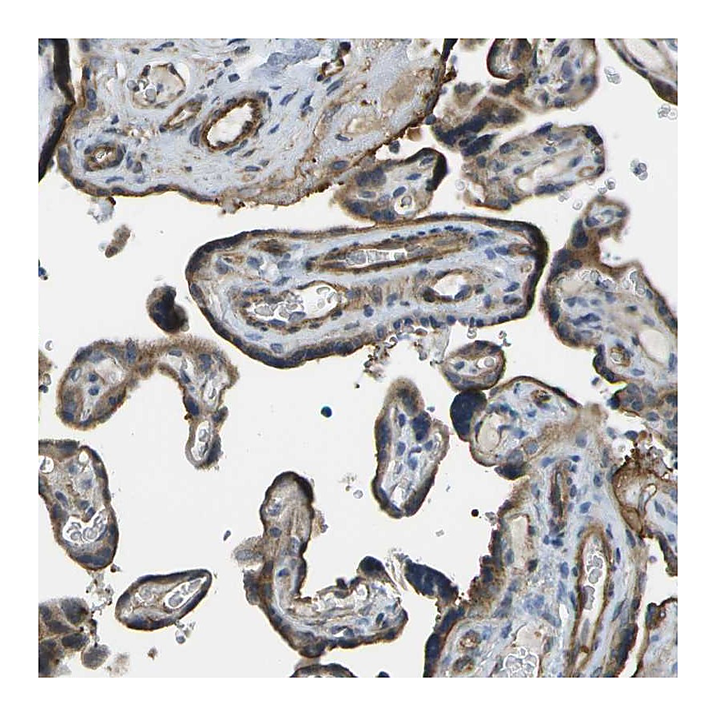Atlas Antibodies Anti-KIAA0040 Antibody