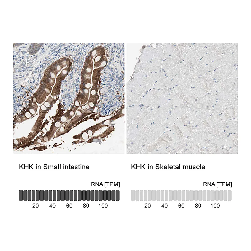 Atlas Antibodies Anti-KHK Antibody