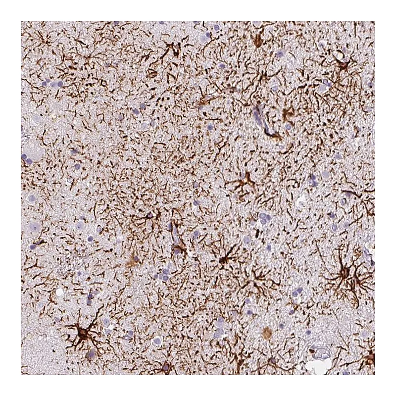Atlas Antibodies Anti-KIAA0368 Antibody