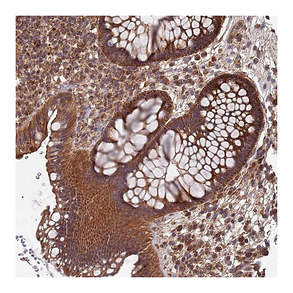 Atlas Antibodies Anti-KIAA0391 Antibody