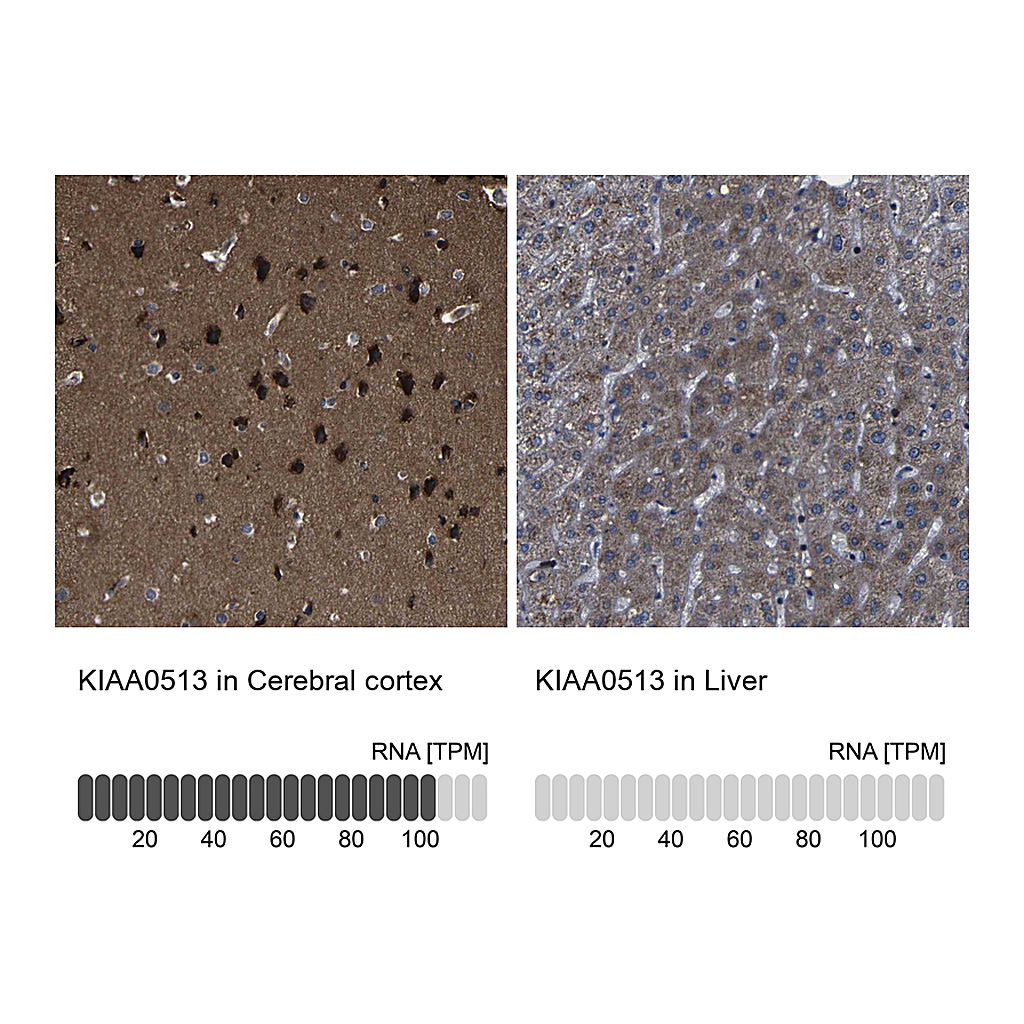 Atlas Antibodies Anti-KIAA0513 Antibody
