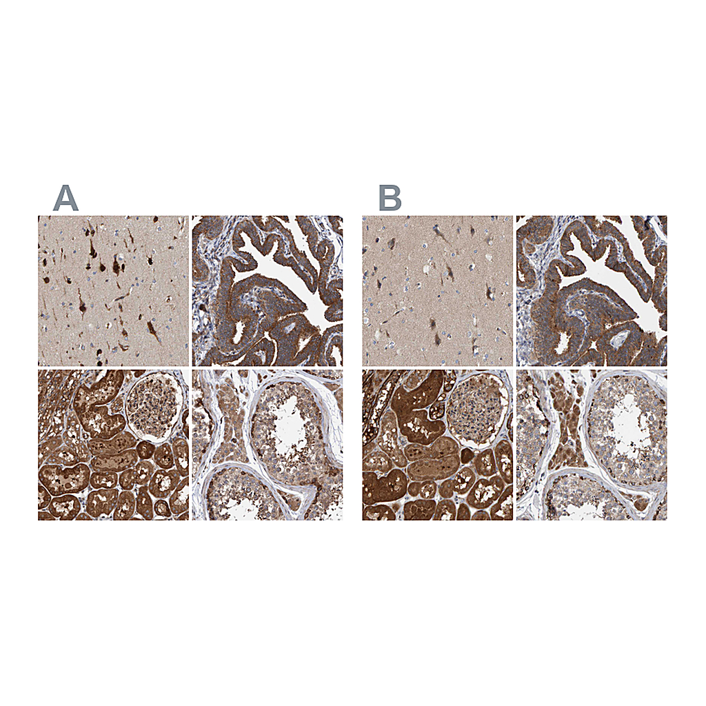 Atlas Antibodies Anti-KIAA0753 Antibody