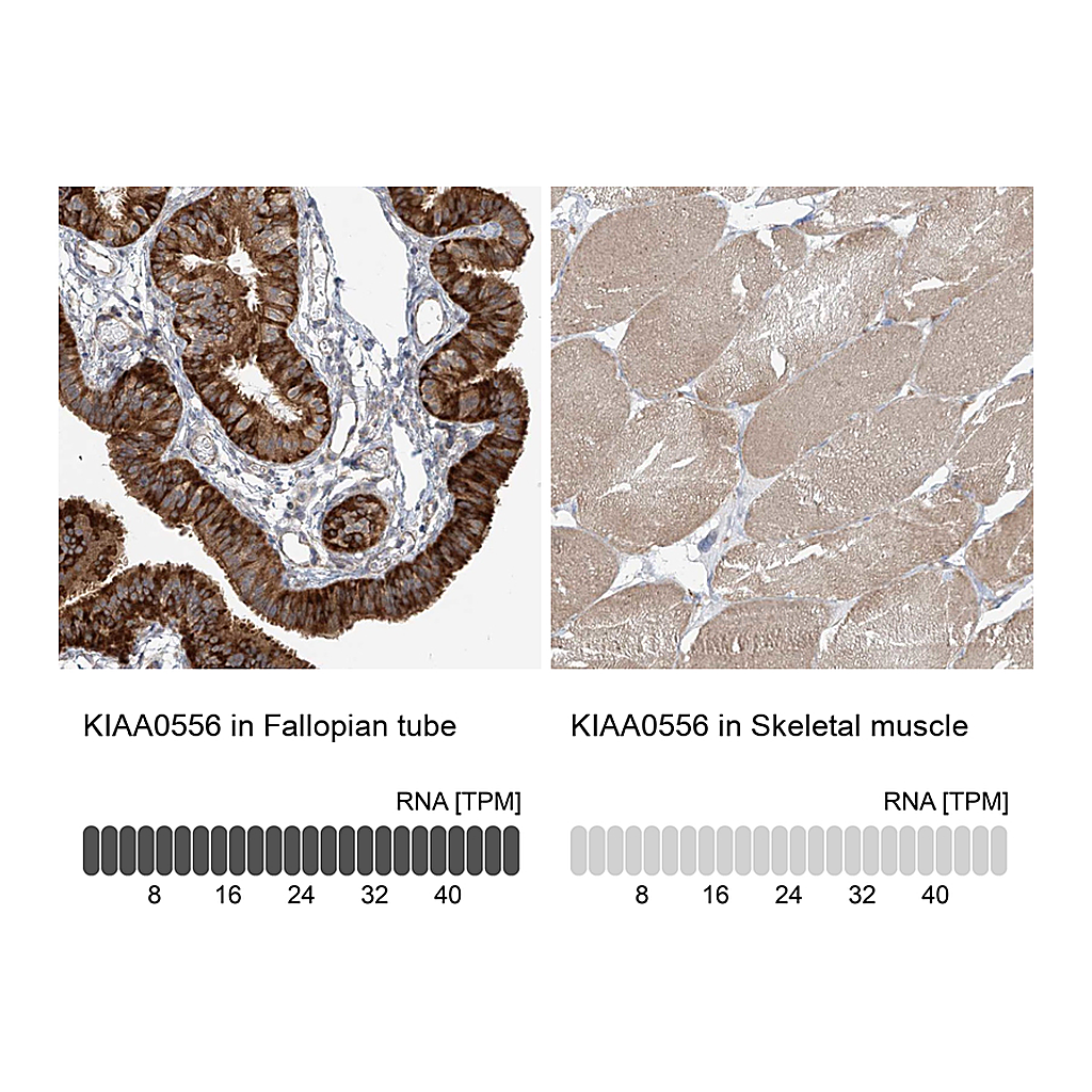 Atlas Antibodies Anti-KIAA0556 Antibody