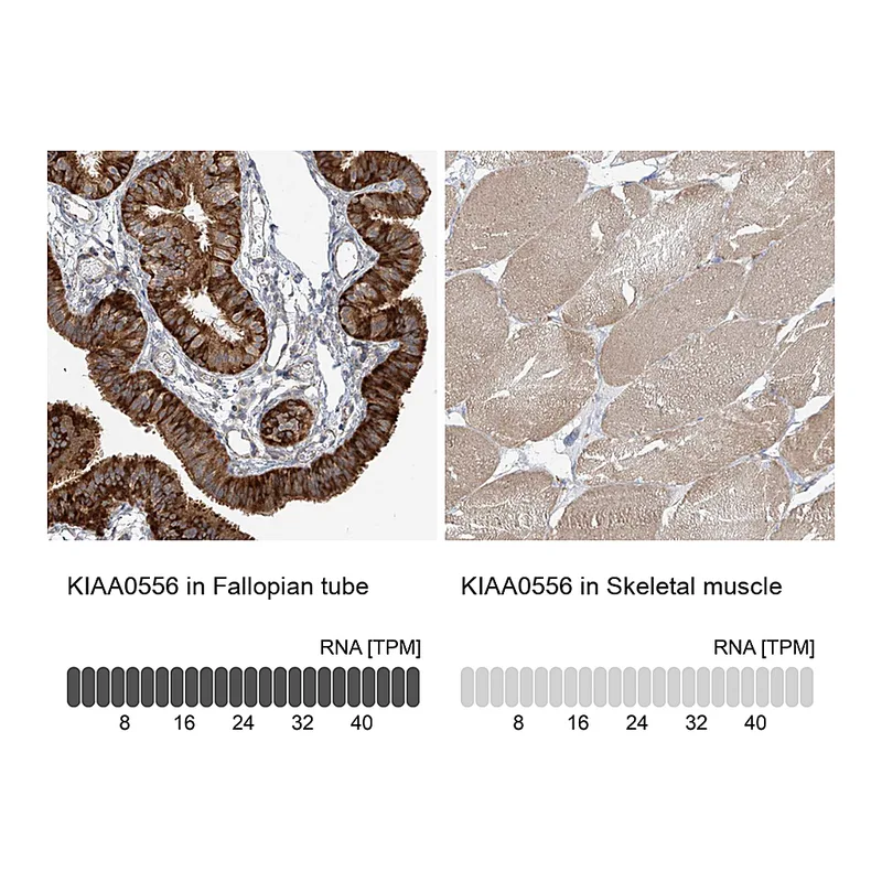 Atlas Antibodies Anti-KIAA0556 Antibody