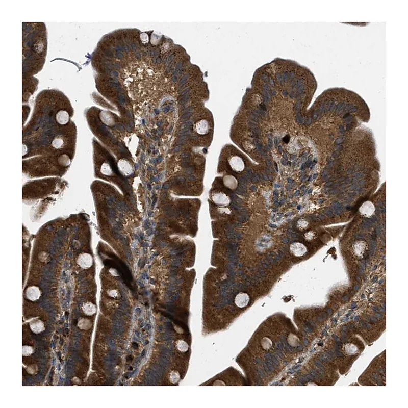 Atlas Antibodies Anti-KIAA0430 Antibody