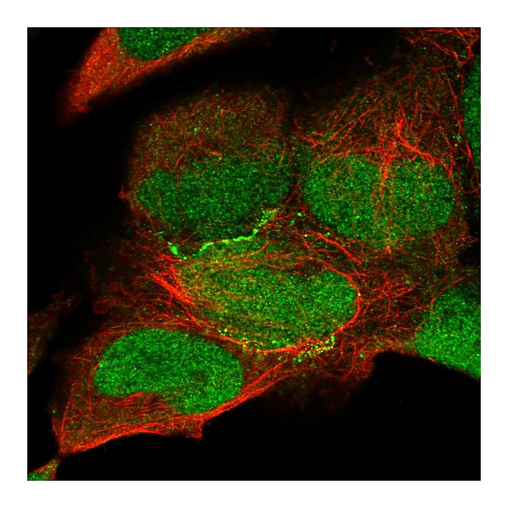 Atlas Antibodies Anti-KIAA0895 Antibody
