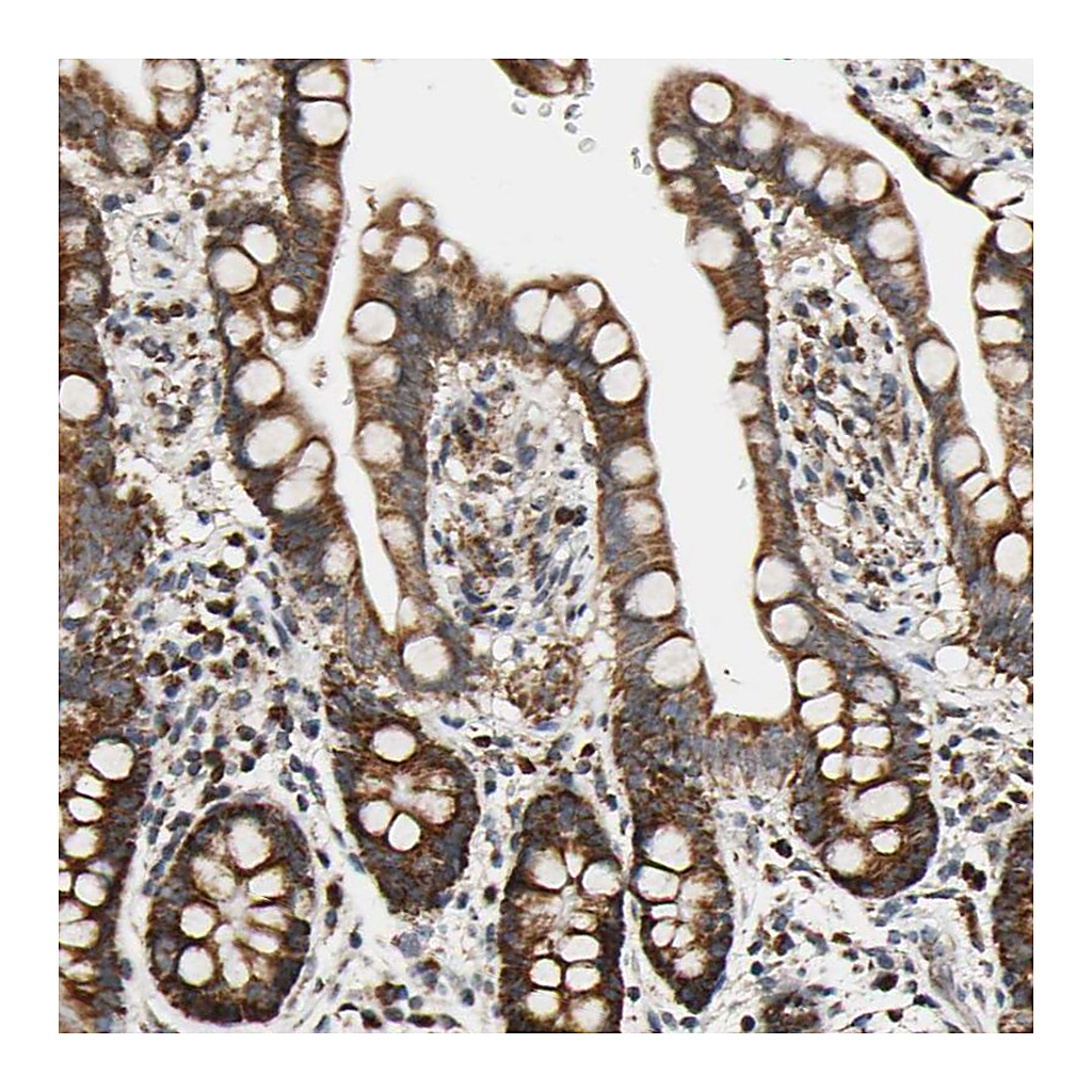 Atlas Antibodies Anti-KIAA0907 Antibody