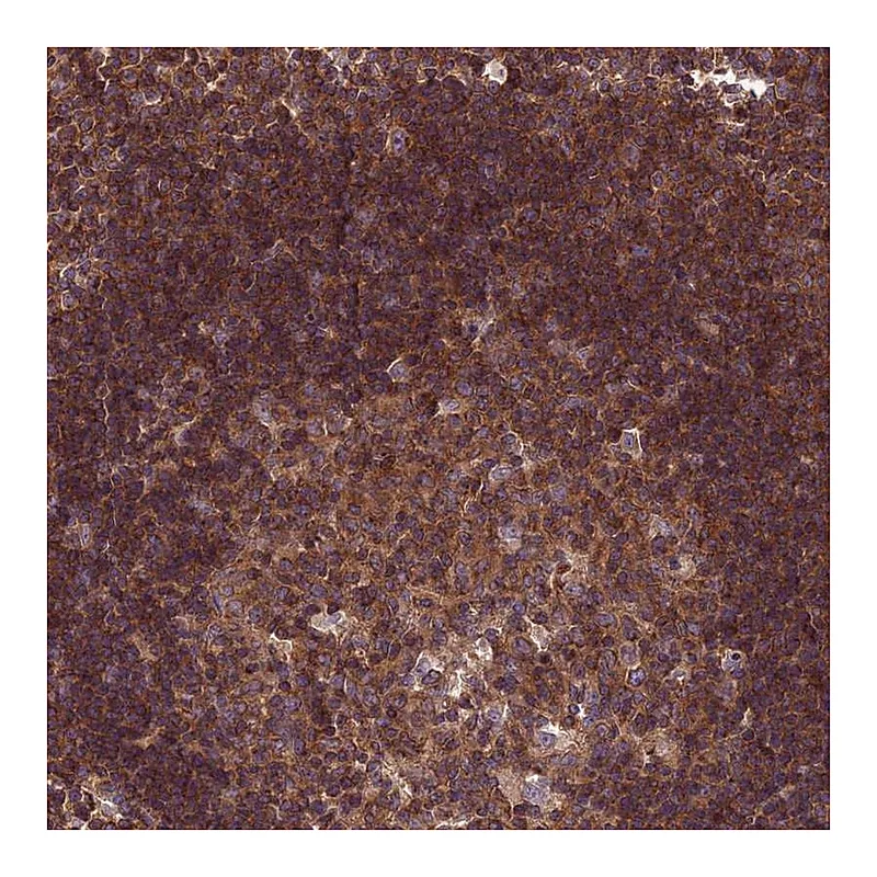 Atlas Antibodies Anti-KIAA0922 Antibody