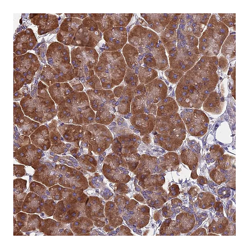 Atlas Antibodies Anti-KIAA1143 Antibody