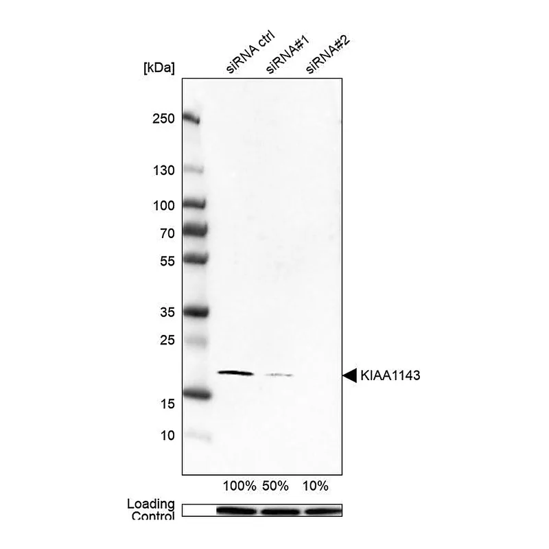 Atlas Antibodies Anti-KIAA1143 Antibody