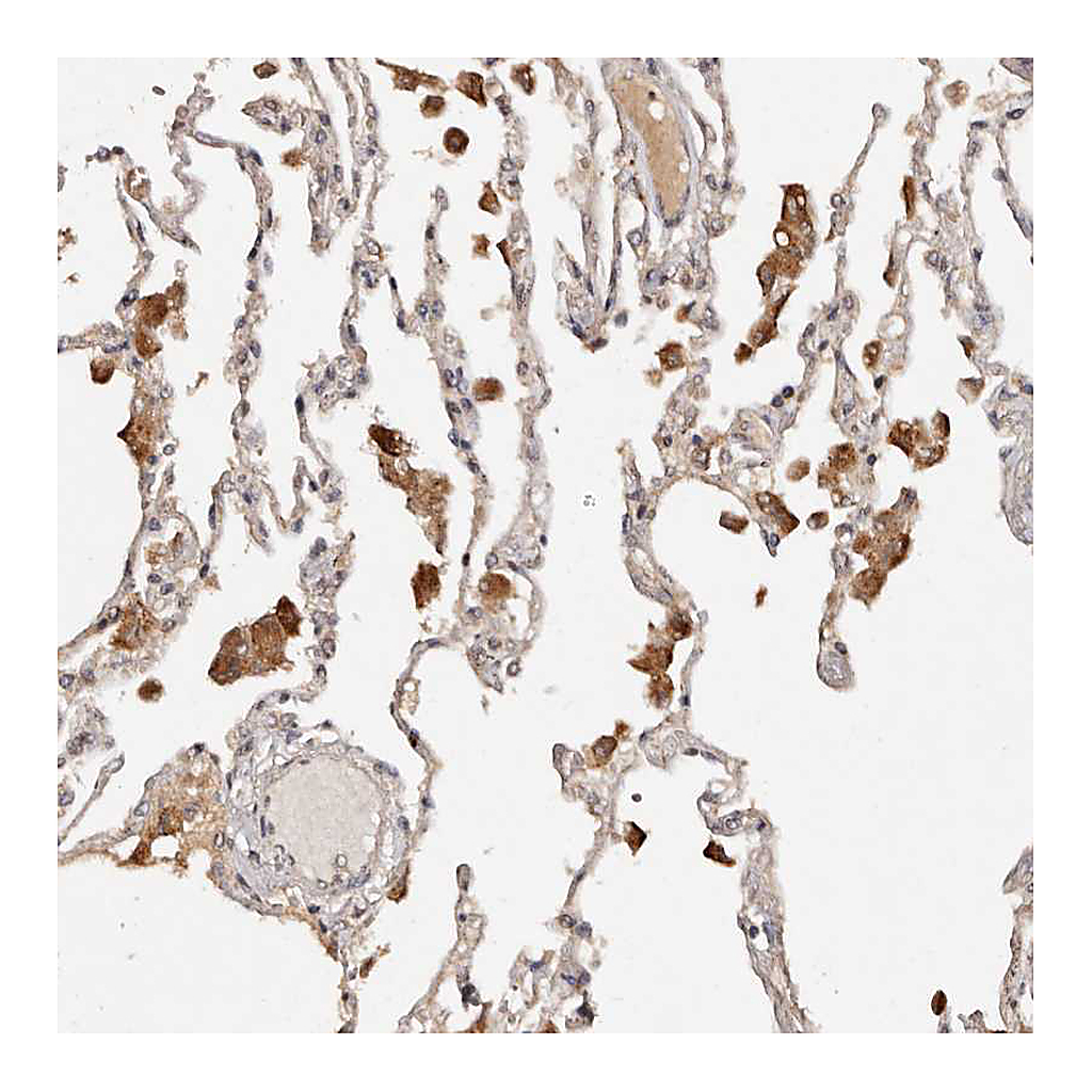 Atlas Antibodies Anti-KIAA1147 Antibody