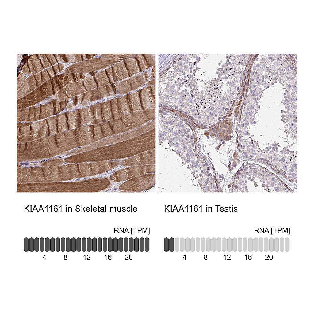 Atlas Antibodies Anti-KIAA1161 Antibody