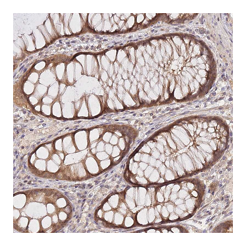 Atlas Antibodies Anti-KIAA1191 Antibody