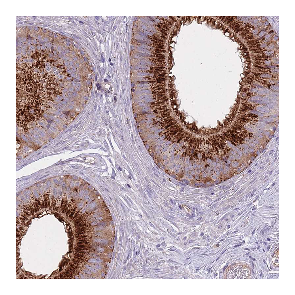 Atlas Antibodies Anti-KIAA1211L Antibody
