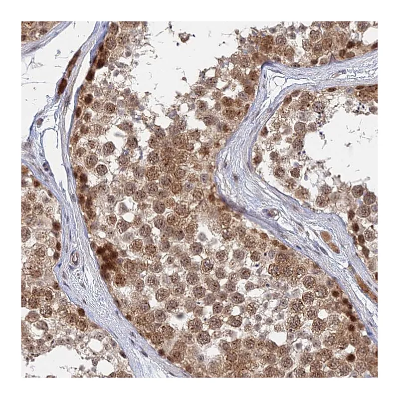 Atlas Antibodies Anti-KIAA1257 Antibody