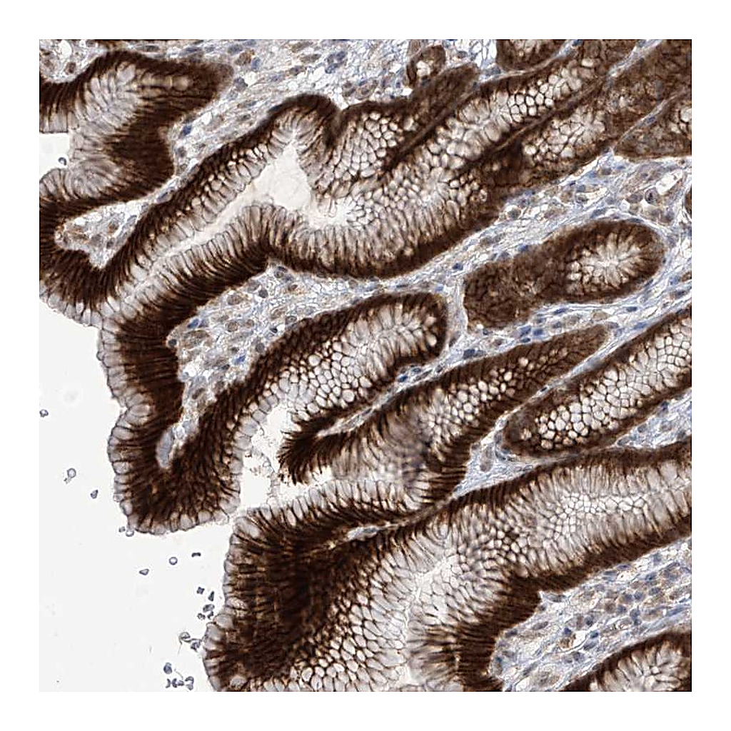 Atlas Antibodies Anti-KIAA1522 Antibody