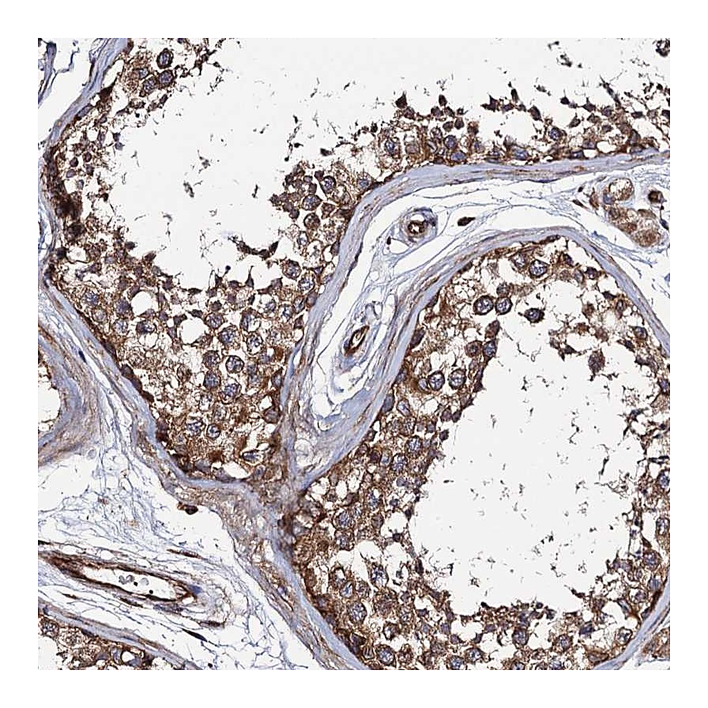 Atlas Antibodies Anti-KIAA1524 Antibody