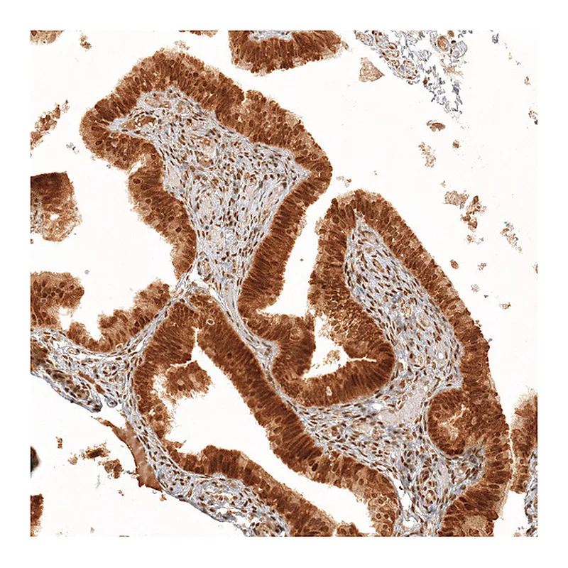 Atlas Antibodies Anti-KIAA1551 Antibody