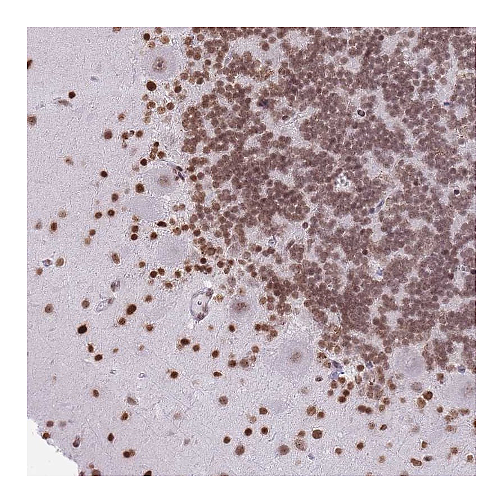 Atlas Antibodies Anti-KIAA1644 Antibody