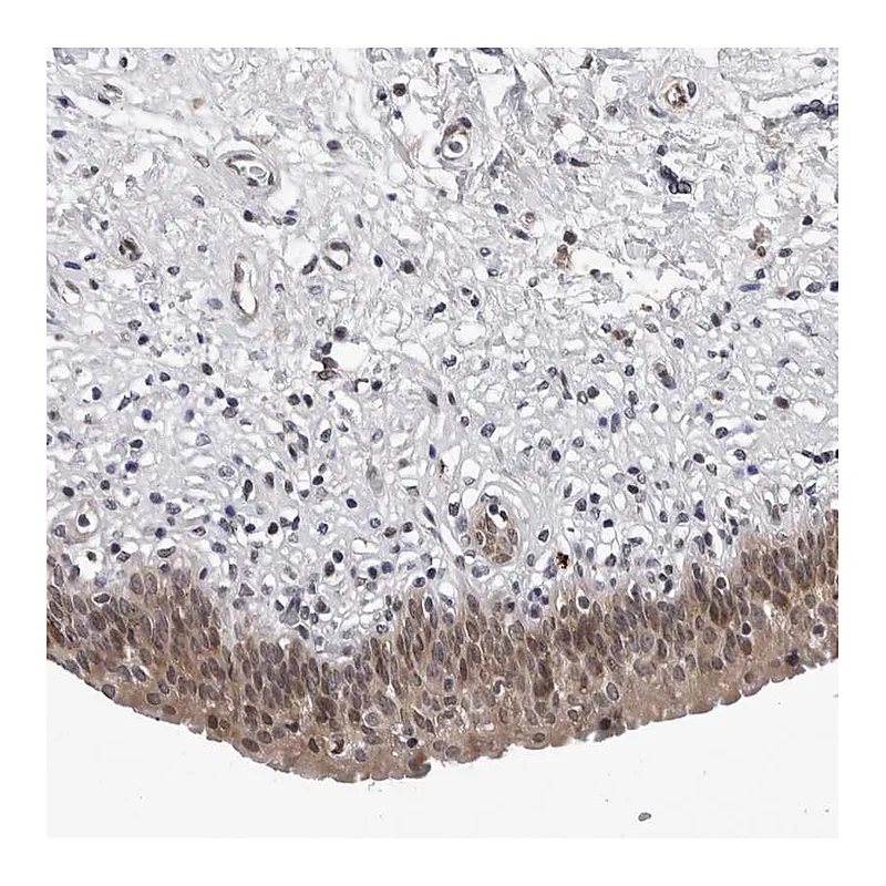 Atlas Antibodies Anti-KIAA1614 Antibody