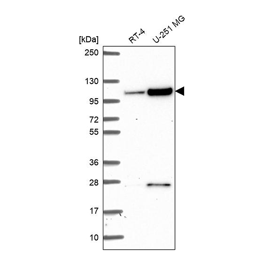 Atlas Antibodies Anti-KIAA1614 Antibody