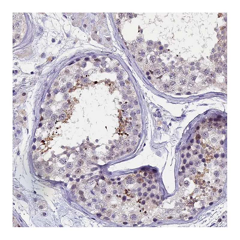 Atlas Antibodies Anti-KIAA1683 Antibody