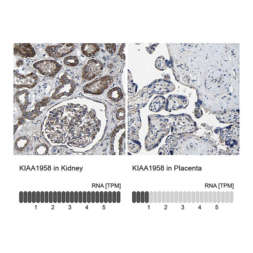 Atlas Antibodies Anti-KIAA1958 Antibody