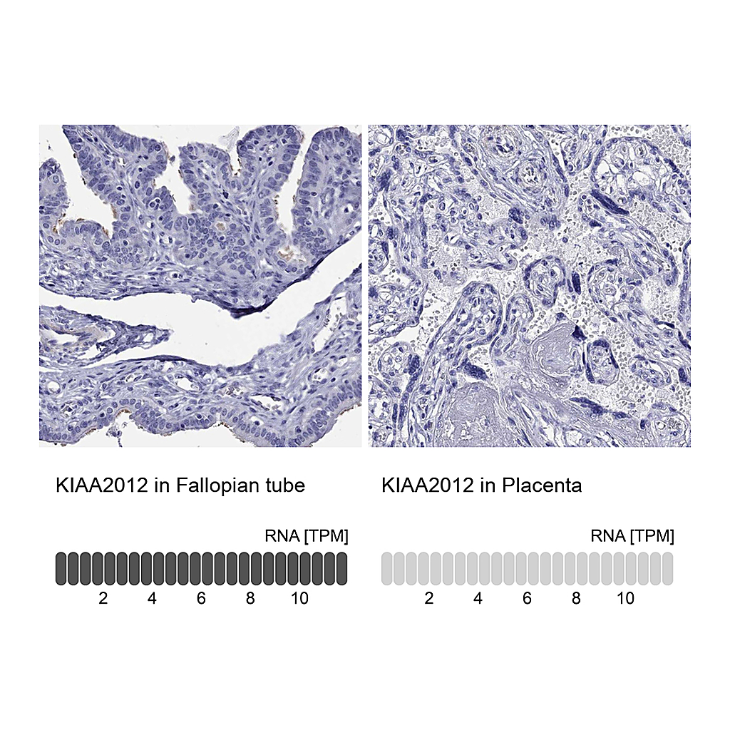 Atlas Antibodies Anti-KIAA2012 Antibody