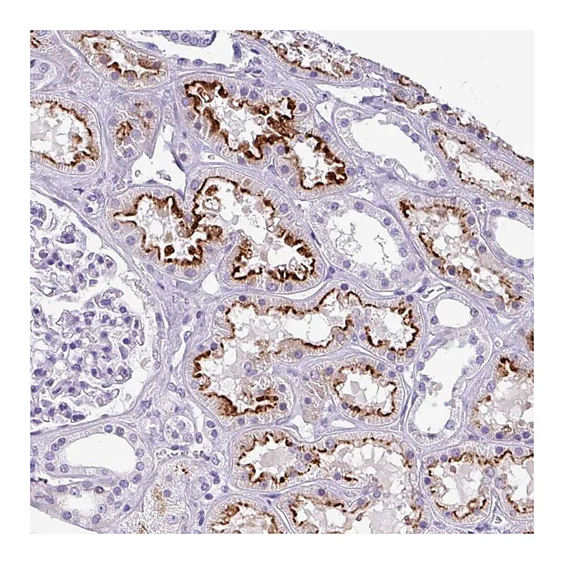 Atlas Antibodies Anti-KIAA2013 Antibody