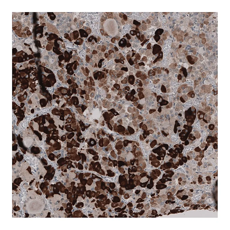 Atlas Antibodies Anti-KIAA2022 Antibody