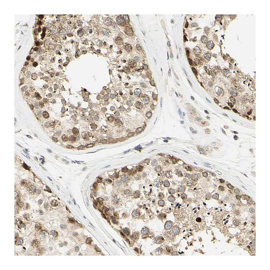 Atlas Antibodies Anti-KIF11 Antibody