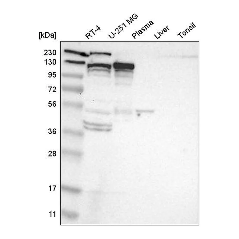 Atlas Antibodies Anti-KIF11 Antibody