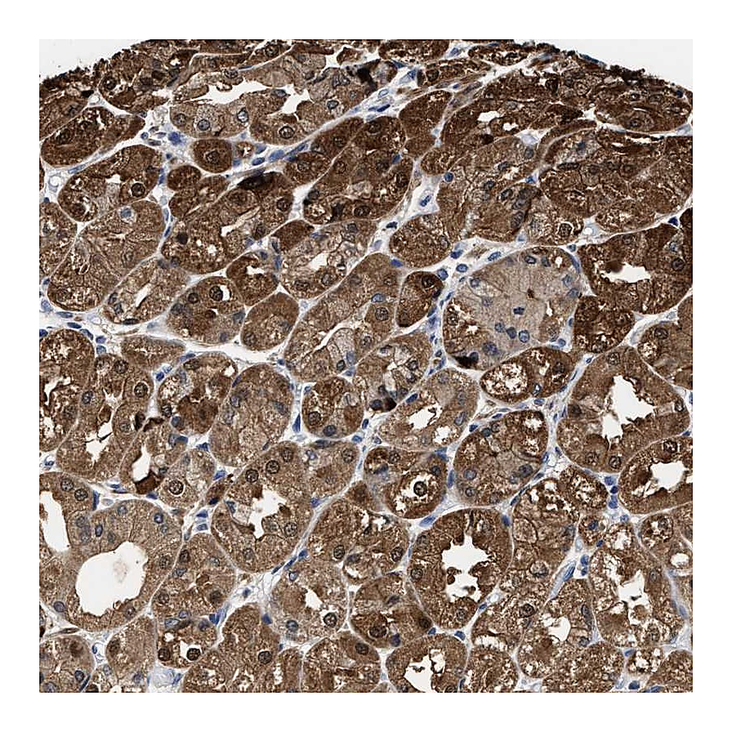 Atlas Antibodies Anti-KIF12 Antibody