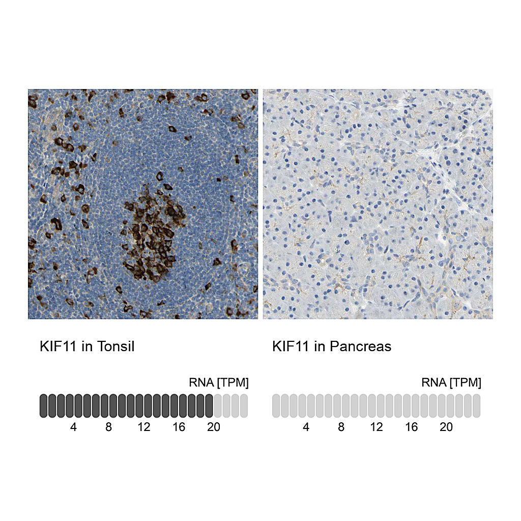 Atlas Antibodies Anti-KIF11 Antibody