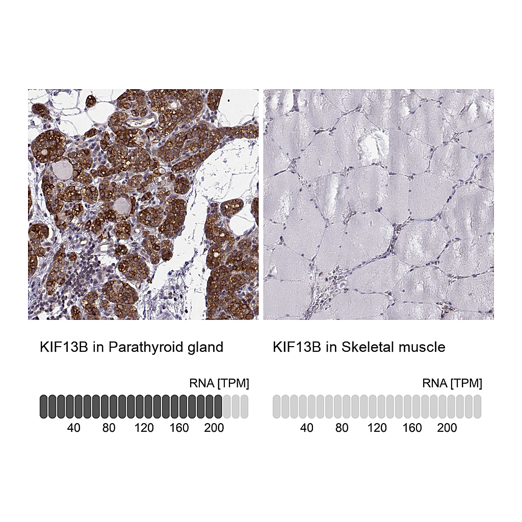Atlas Antibodies Anti-KIF13B Antibody