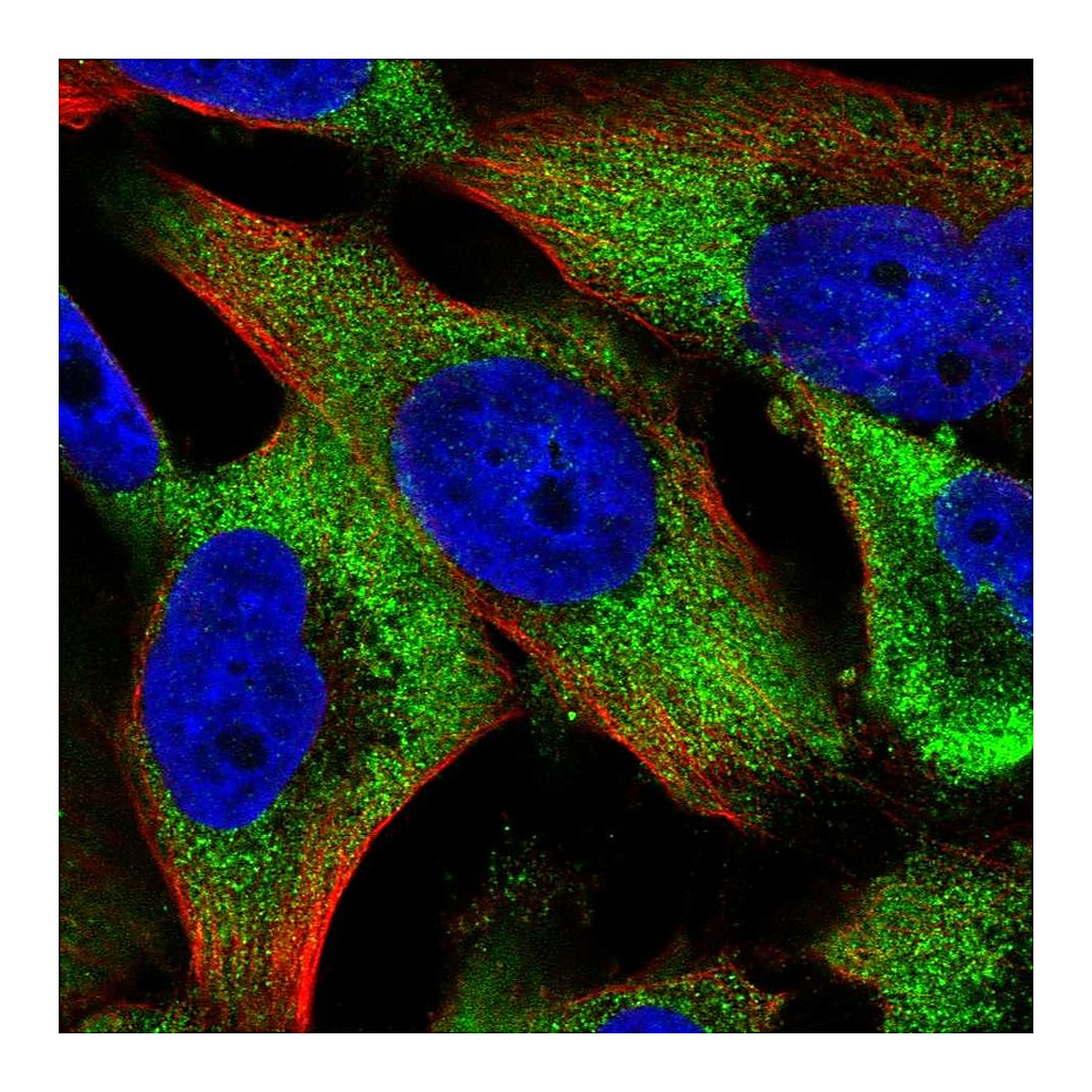 Atlas Antibodies Anti-KIF14 Antibody
