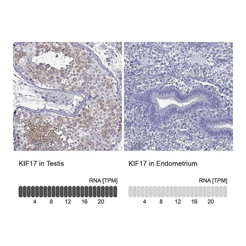 Atlas Antibodies Anti-KIF17 Antibody