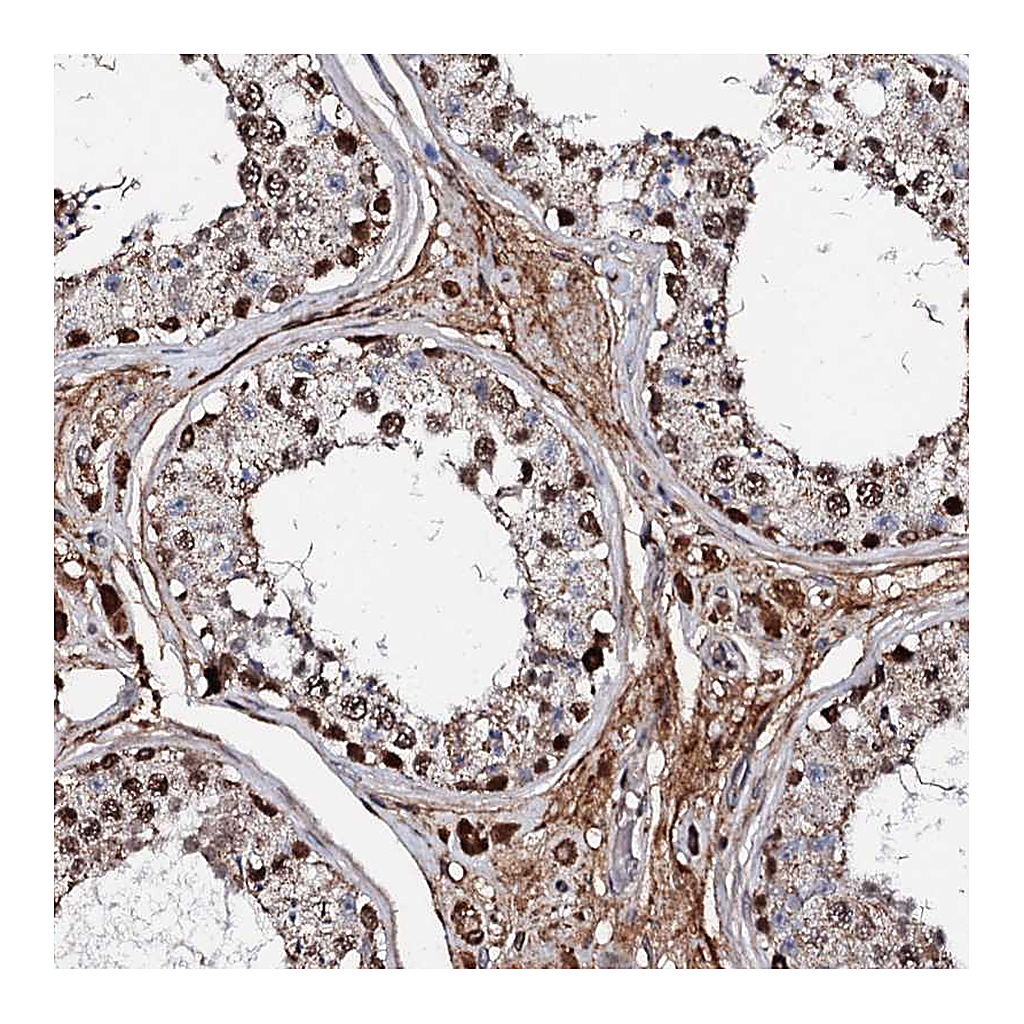Atlas Antibodies Anti-KIF18A Antibody