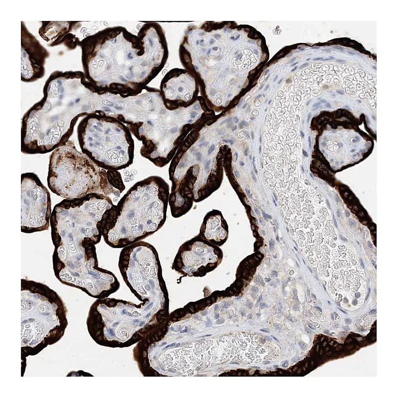 Atlas Antibodies Anti-KIF1BP Antibody