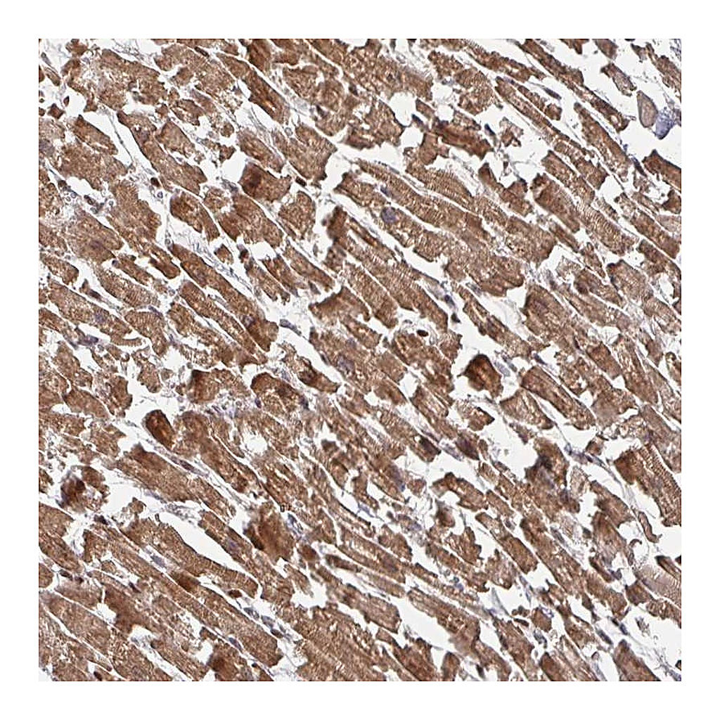 Atlas Antibodies Anti-KIF1C Antibody
