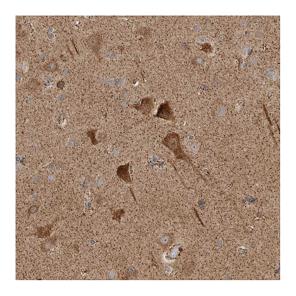 Atlas Antibodies Anti-KIF21B Antibody