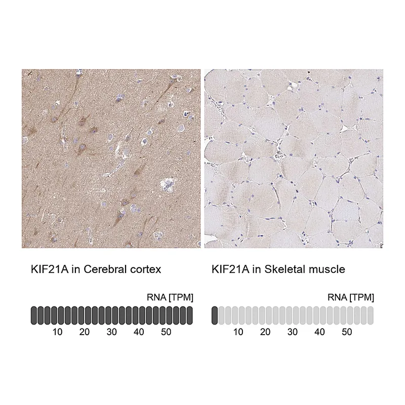 Atlas Antibodies Anti-KIF21A Antibody
