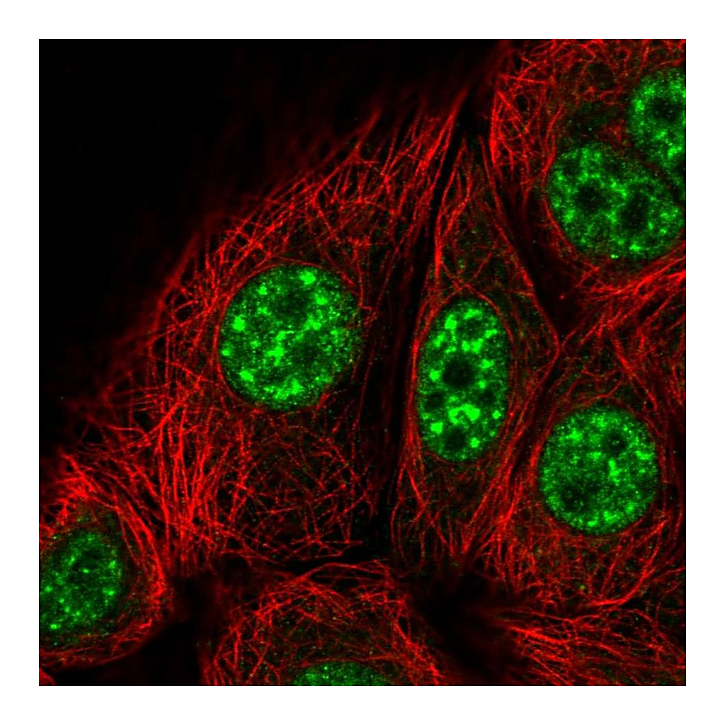 Atlas Antibodies Anti-KIF22 Antibody
