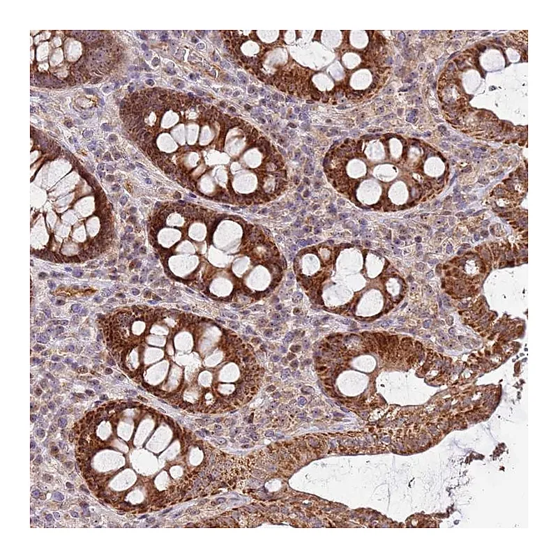 Atlas Antibodies Anti-KIF25 Antibody