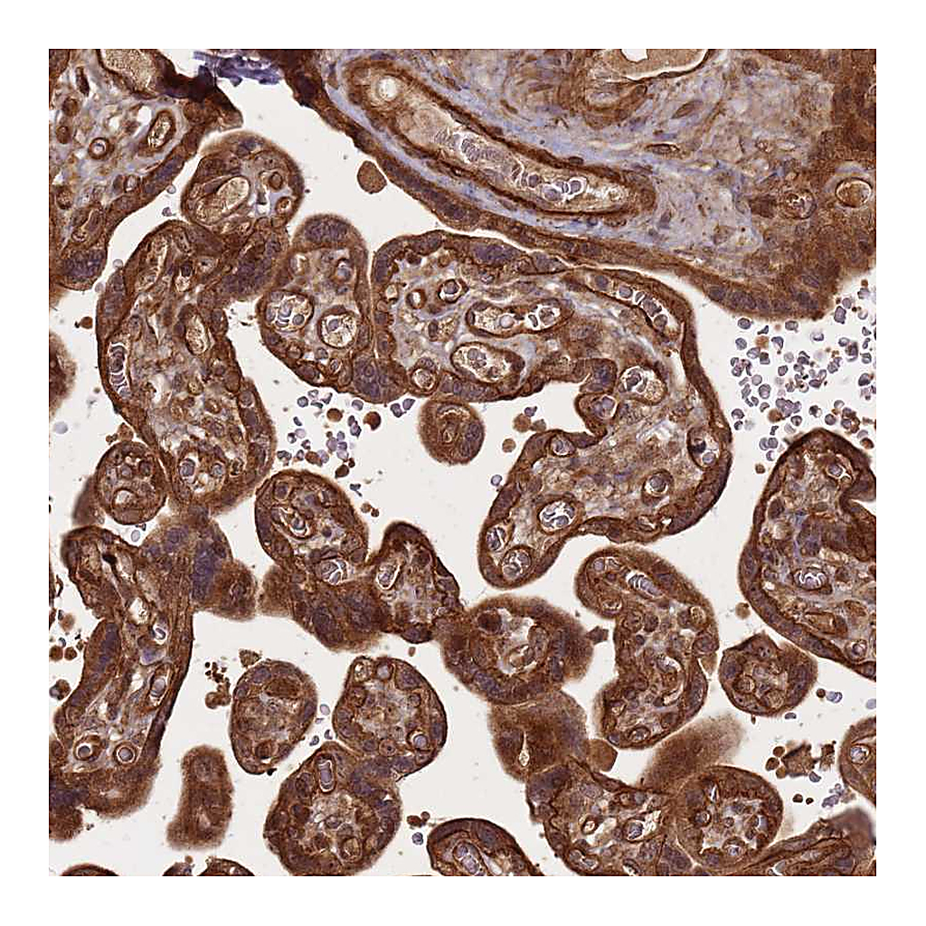 Atlas Antibodies Anti-KIF26A Antibody
