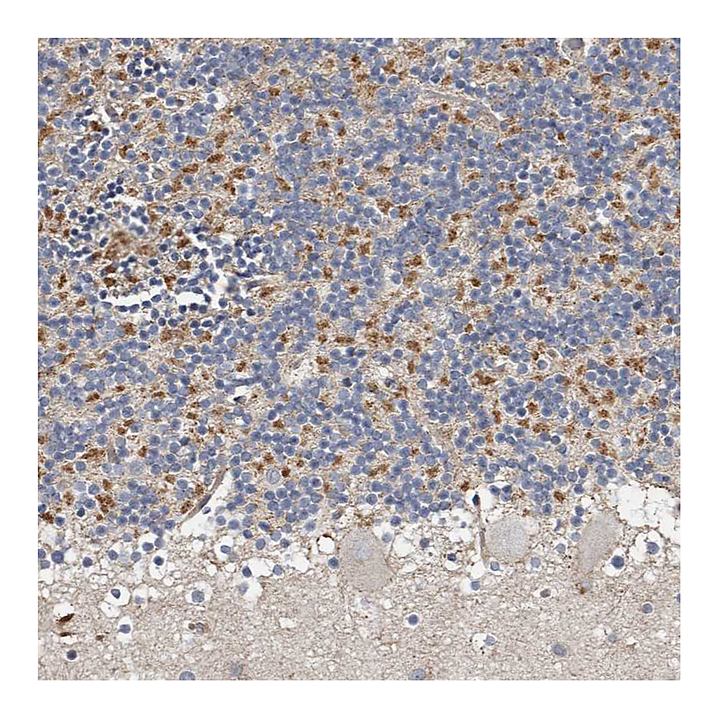 Atlas Antibodies Anti-KIF26B Antibody