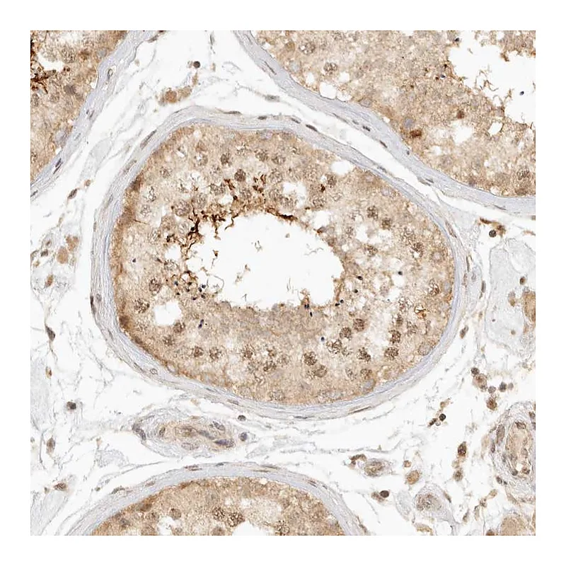 Atlas Antibodies Anti-KIF2B Antibody