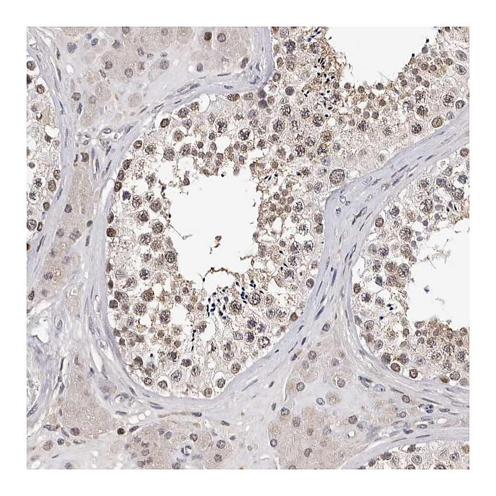 Atlas Antibodies Anti-KIF2B Antibody