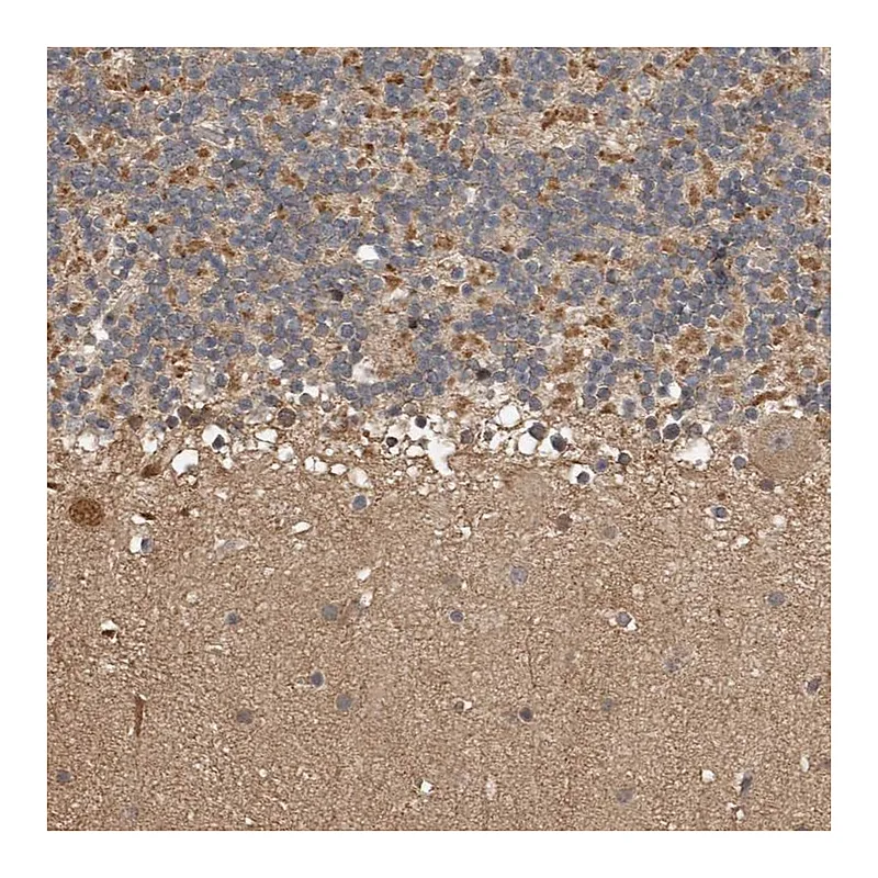 Atlas Antibodies Anti-KIF26B Antibody